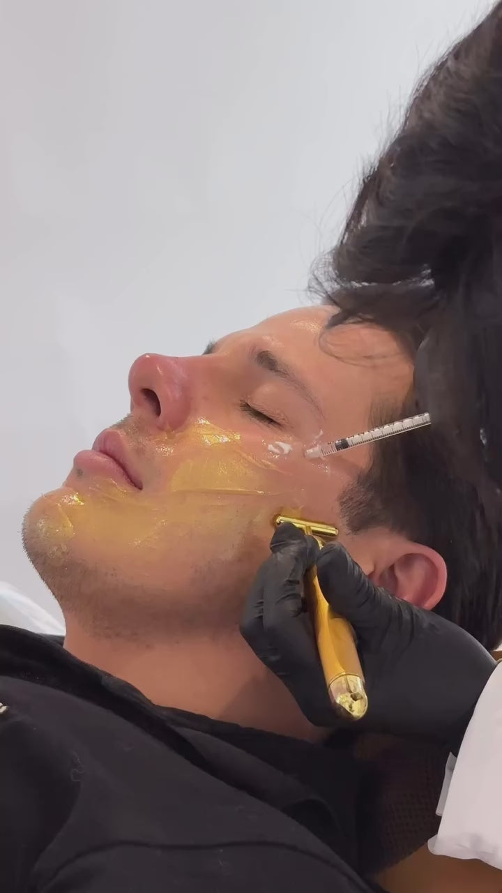 APLICACIÓN DE TOXINA BOTULÍNICA